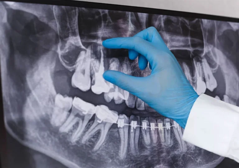 endodontie-drdent
