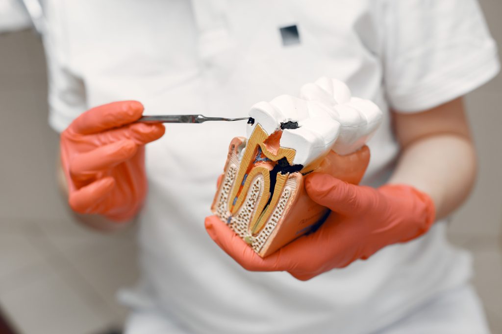 endodontie-craiova1