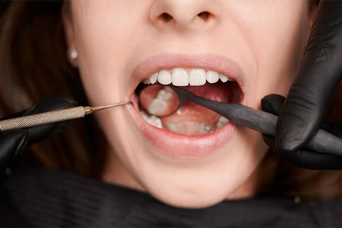 profilaxie-craiova-dr-dent